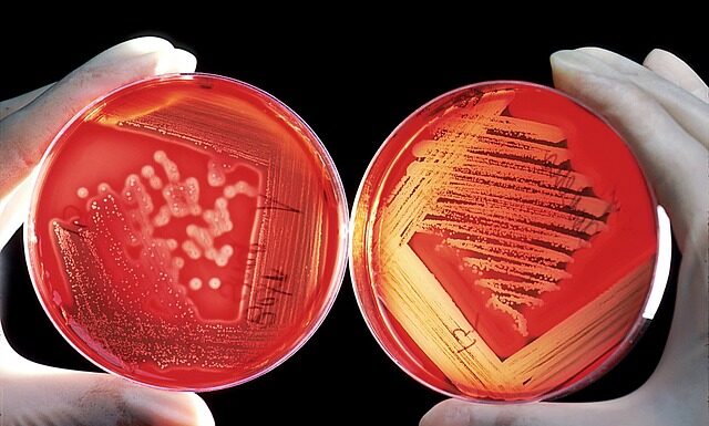 Czy Agar to to samo co pektyna?